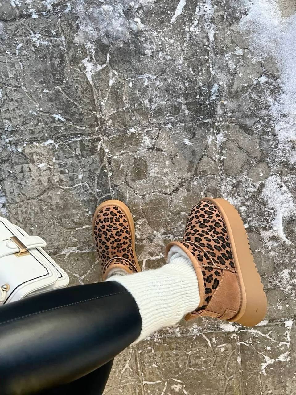 Botas Ugg Leopard – Link da Hacoo · foto 3